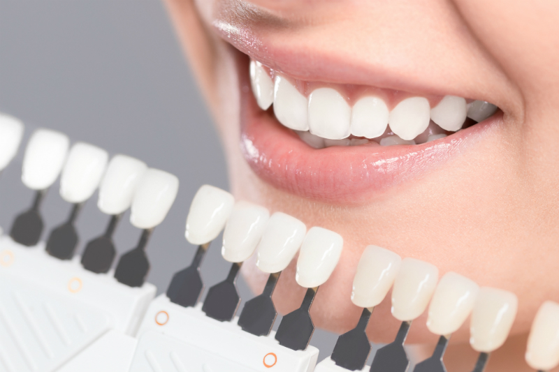 When to See a General Dentist To Get Teeth Whitening Services